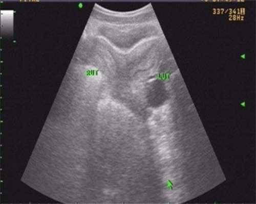 国内供卵自怀多少钱,深圳有哪些有名的试管婴儿医院？技术水平如何？