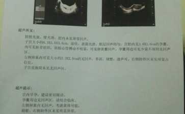 国内预约供卵流程,三代试管选性别的费用是多少?有什么利弊?