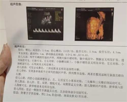 国内咨询试管供卵公司,宝鸡能做试管婴儿吗试管技术选择哪一代更便宜