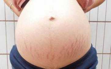 孕早期吃补佳乐的作用有什么？~~代妈应聘