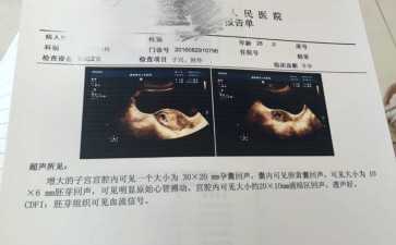 国内代怀花费,2025吉安有卵子库吗内附供卵试管条件明细