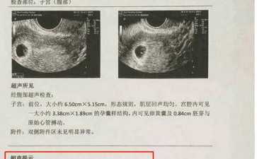 国内专业的代孕网,网友真实经验分享，为你详解他莫昔芬促排情况